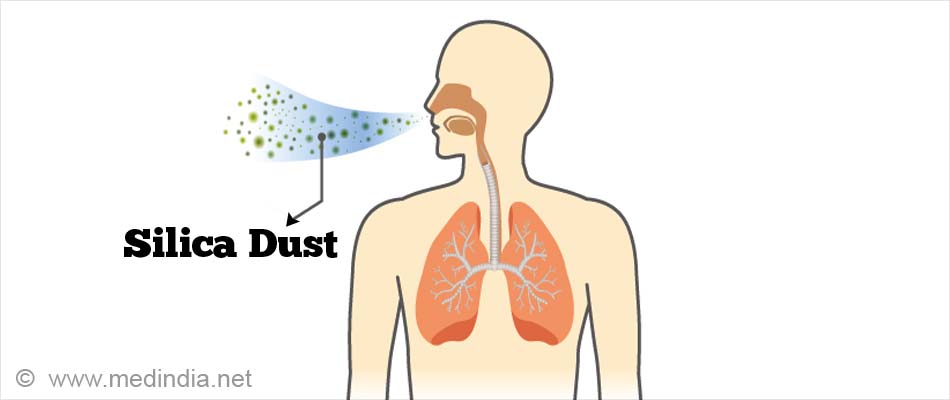 Silicosis PICTURE